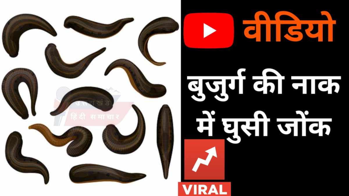 वीडियो : बुजुर्ग की नाक में घुसी जोंक