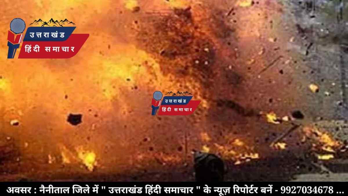 हादसा : विस्फोटक से झुलसे हाथ , इस सप्ताह में कुमाऊं का दूसरा मामला