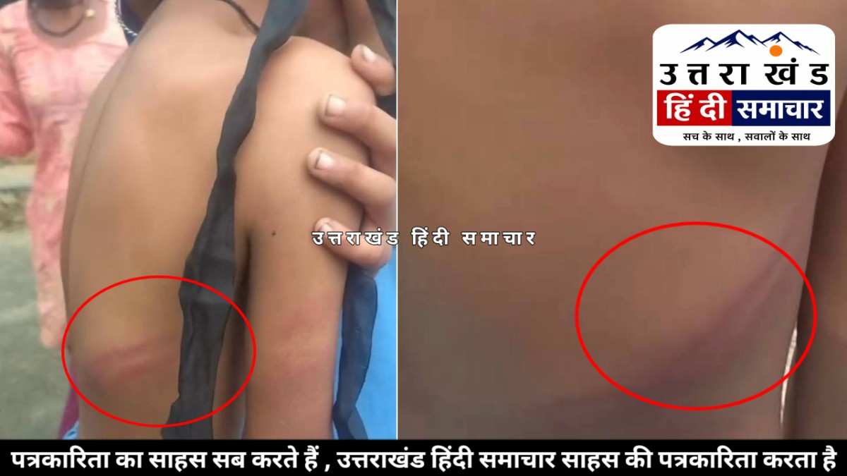 सनसनीखेज मामला : स्कूल में छात्रा की कथित पिटाई से सनसनी ! शिक्षक पर गंभीर आरोप